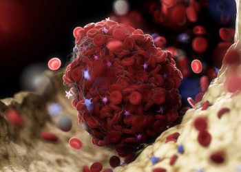 Необичаен имунен отговор причинява съсиреците